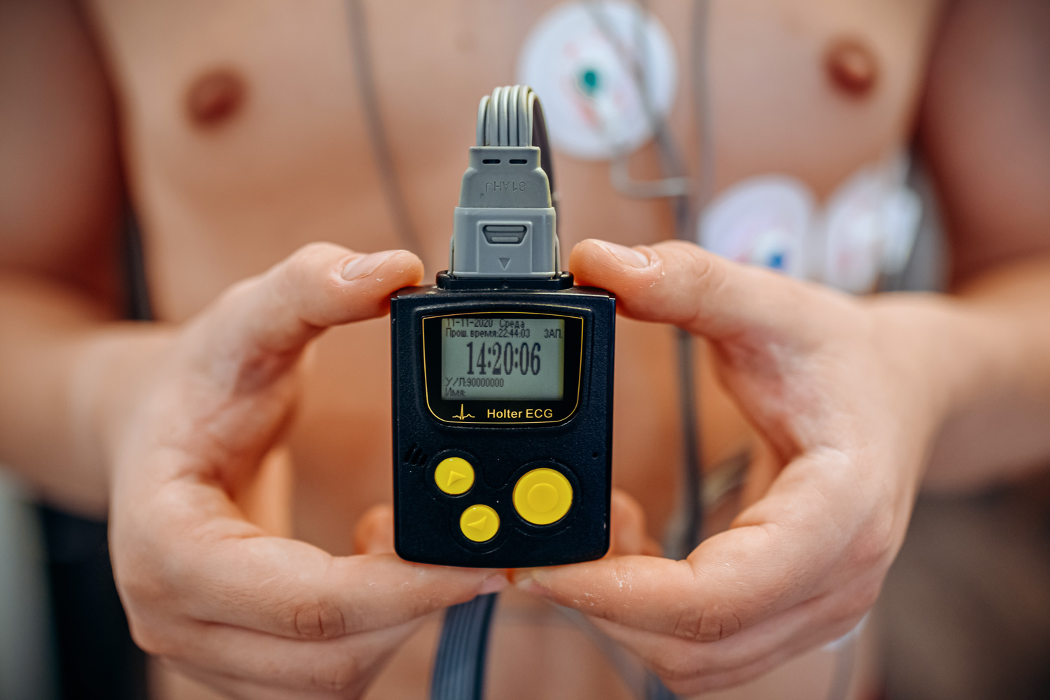 holter-ECG-delle-24-ore-a-12-derivazioni